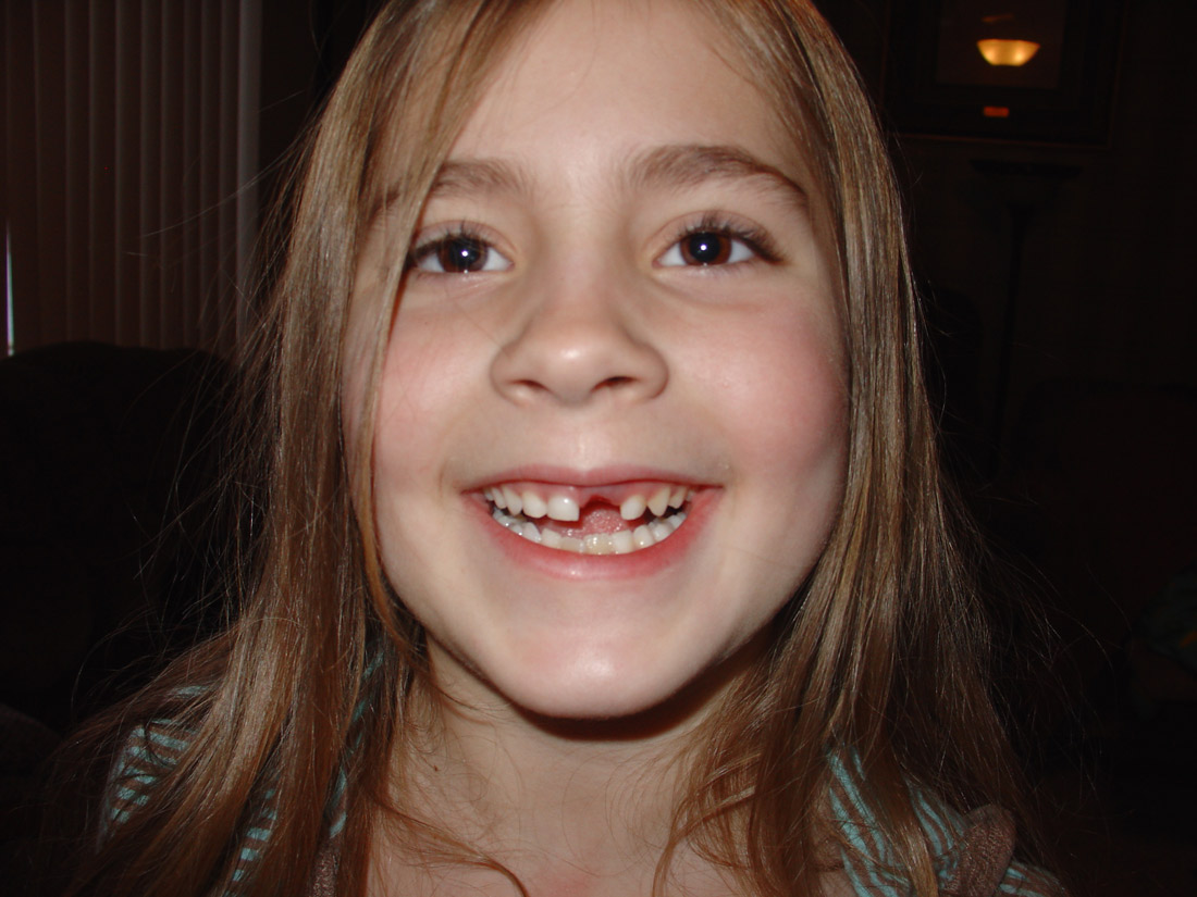 ../use_images/2010/tric_first_tooth.jpg ../use_images/2010/tric_first_tooth.jpg